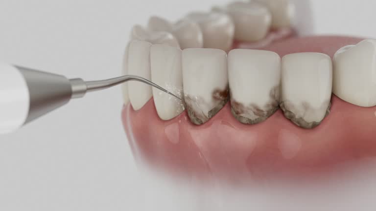 Trusted Teeth Cleaning And Checkup service in Kewaskum, WI - Dentist Open Now